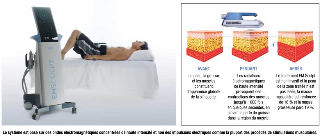 Em Sculp des abdos sans peine Dr Leduc Paris Em Sculp des abdos sans peine Dr Leduc Paris